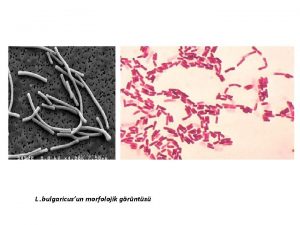 L bulgaricusun morfolojik grnts Streptococcus thermophilus G gram