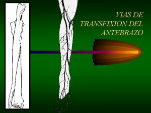 VIAS DE TRANSFIXION DEL ANTEBRAZO VIAS DE TRANSFIXION