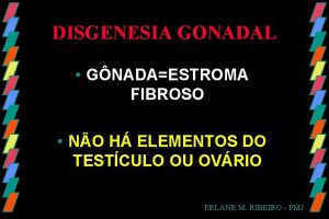 DISGENESIA GONADAL GNADAESTROMA FIBROSO NO H ELEMENTOS DO