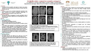 Encphalites virales comment les reconnaitre en imagerie H