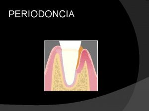 PERIODONCIA Diagnstico en Periodoncia Posicin da marxe xenxival