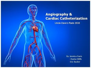 Angiography Cardiac Catheterization Uncle Daves Rads 2030 By