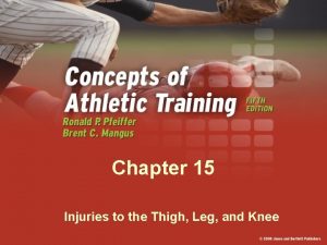 Chapter 15 Injuries to the Thigh Leg and