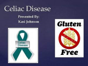 Celiac Disease Presented By Kasi Johnson What is