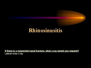 Rhinosinusitis If there is a suspected nasal fracture