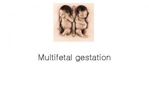 Multifetal gestation Introduction etiology Dizygotic Fraternal twins not