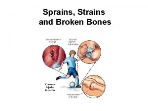 Sprains Strains and Broken Bones Musculoskeletal Injuries Sprain