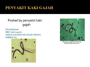 PENYAKIT KAKI GAJAH Posted by penyakit kaki gajah