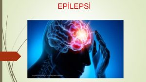 EPLEPS SUEHR REHBERLK VE ARATIRMA MERKEZ EPLEPS Epilepsi