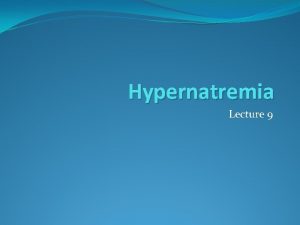 Hypernatremia Lecture 9 Definition Serum Na concentration above