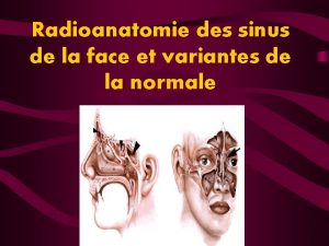 Radioanatomie des sinus de la face et variantes