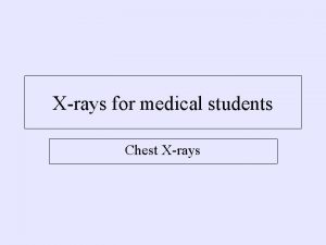 Xrays for medical students Chest Xrays Normal Chest
