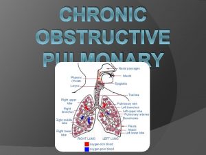 CHRONIC OBSTRUCTIVE PULMONARY DISEASE COPD What is COPD
