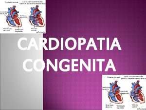CARDIOPATIA CONGENITA INDICE 1 Introduccin 2 Cardiopata congnita