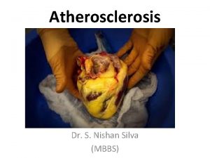 Atherosclerosis Dr S Nishan Silva MBBS Atherosclerosis Atherosclerosis