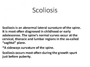 Scoliosis is an abnormal lateral curvature of the