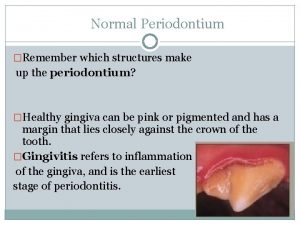Normal Periodontium Remember which structures make up the