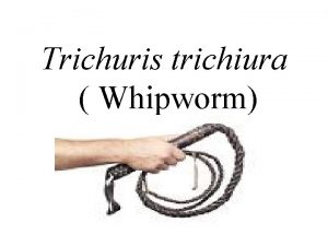 Trichuris trichiura Whipworm Scientific name Trichuris trichiura Common