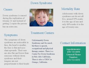 Down Syndrome Mortality Rate Causes Adolescents with down