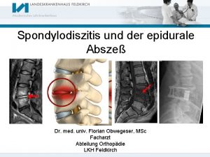 Spondylodiszitis und der epidurale Absze Dr med univ