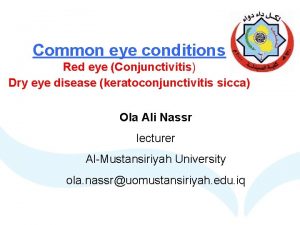 Common eye conditions Red eye Conjunctivitis Dry eye