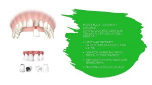 MODELACIJA ULAGANJE I LJEVANJE KORNELI DORAI DENTALNI TEHNIAR