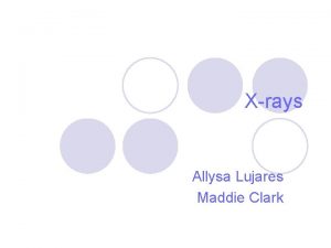 Xrays Allysa Lujares Maddie Clark Xrays l Xrays