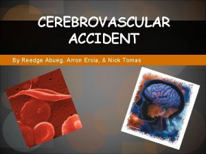 CEREBROVASCULAR ACCIDENT By Reedge Abueg Arron Ercia Nick