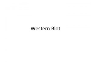 Western Blot Steps 1 SDSPAGE 2 Transfer to