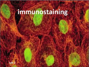 immunostaining Lab 2 What is IHC Immunohistochemistry IHC