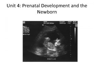 Unit 4 Prenatal Development and the Newborn How