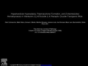 Hepatocellular Hyperplasia Plasmacytoma Formation and Extramedullary Hematopoiesis in