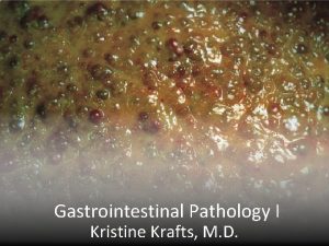 Gastrointestinal Pathology I Kristine Krafts M D GI