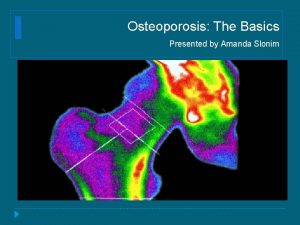 Osteoporosis The Basics Presented by Amanda Slonim What