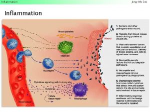 Inflammation JongMo Seo Inflammation JongMo Seo Inflammation JongMo