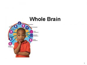 Whole Brain 1 Lessons learnt from research Understanding