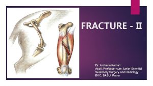 FRACTURE II Dr Archana Kumari Asstt Professor cum