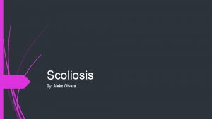 Scoliosis By Aleks Olvera What is Scoliosis Scoliosis