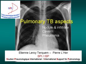 Pulmonary TB aspects Nodule infiltrate Cavern Pneumonia Etienne
