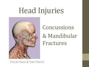 Head Injuries Concussions Mandibular Fractures Priscila Pazos Tyler