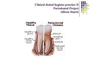 Clinical dental hygiene practice II Periodontal Project Allison