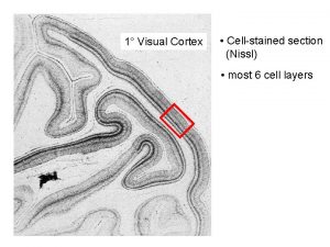 1 Visual Cortex Cellstained section Nissl most 6