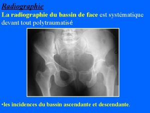 Radiographie La radiographie du bassin de face est