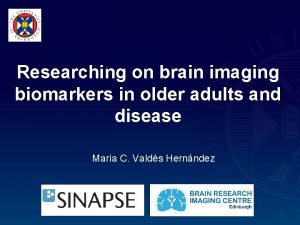 Researching on brain imaging biomarkers in older adults