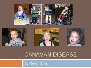 CANAVAN DISEASE By Susan Buss Other Names For