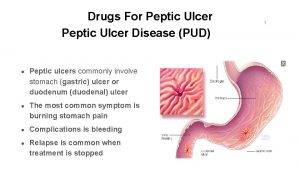 Drugs For Peptic Ulcer Disease PUD Peptic ulcers