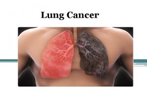 Lung Cancer DEFINITION Lung cancer is an a