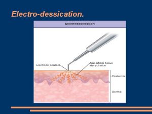 Electrodessication Plasma and Localised Skin Tightening Plasma and