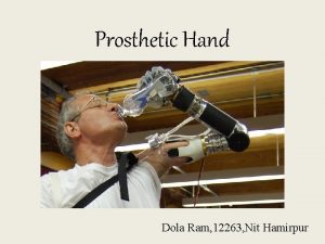 Prosthetic Hand Dola Ram 12263 Nit Hamirpur Prosthetics