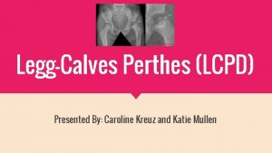 LeggCalves Perthes LCPD Presented By Caroline Kreuz and